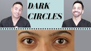 Dark Circles Causes amp Treatments  Dermatologist Perspective [upl. by Enitsud]