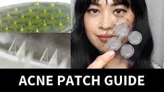 Guide to Acne Patches Hydrocolloid Treatment Microneedle  Lab Muffin Beauty Science [upl. by Alekram]