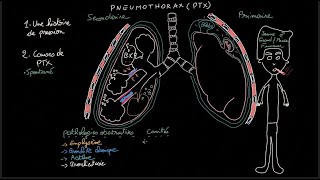 Pneumothorax  Docteur Synapse [upl. by Wylie546]