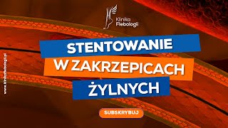 Stentowanie w zakrzepicach żylnych Klinika Flebologii [upl. by Goar]