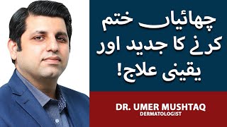 Chaiyan Khatam Karne Ka Tarika  How To Treat Pigmentation Permanently  Dr Umer Mushtaq [upl. by Kristie]