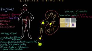 Lithiase urinaire  Docteur Synapse [upl. by Yht]