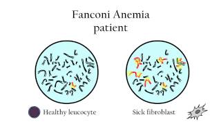 Fanconi Anemia  Genetic diagnosis [upl. by Whiney]