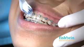 Orthodontic Home Care Instructions  Braces  Brushing [upl. by Aseena978]