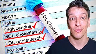 LDL Cholesterol level Your lab results explained [upl. by Kcirdde56]