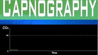 EtCO2 Capnography Part 4 [upl. by Ocirred304]