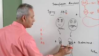 Blood Transfusion Reaction Part 13 Hematology [upl. by Chadbourne]