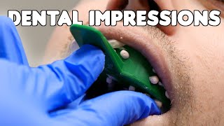 Dental Impressions amp Pouring Teeth Models [upl. by Rahel]