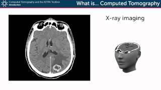 What is Computed Tomography [upl. by Kile]