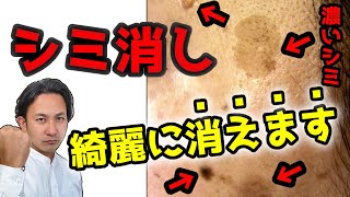 濃いシミも消す一番の方法はこれ！昔の美肌が蘇る。【化粧品原料のプロが解説】 [upl. by Fessuoy]