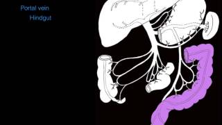 Primary Biliary cirrhosis Lecture [upl. by Silbahc]