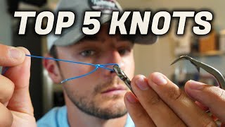 TOP 5 Knots You Should Know Beginners Guide to Fishing [upl. by Silber528]