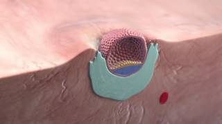 Implantation of the blastocyst [upl. by Asilla865]