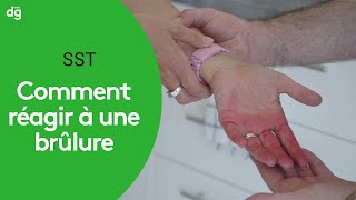 Comment réagir en cas de brûlure  Formation SST [upl. by Tezzil]