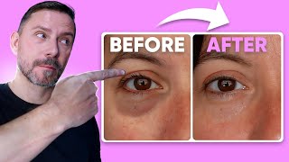 HOW TO MAKE EYE BAGS VANISH IN SECONDS FULL DEMO [upl. by Ekihc]