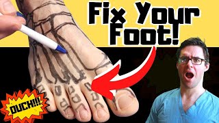 Broken Foot Recovery amp Foot Fracture Home Treatments Top 25 Hacks [upl. by Odlanra]