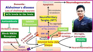 Alzheimers disease and its treatment Donepezil Memantine [upl. by Deden661]