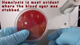 Beta Hemolysis on Blood Agar [upl. by Ocsecnarf279]