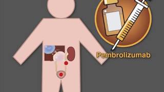 Pembrolizumab as Secondline Therapy for Advanced Urothelial Carcinoma [upl. by Sito123]