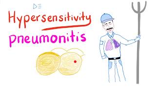 Hypersensitivity Pneumonitis  Restrictive Lung Diseases  Pulmonology [upl. by Brinkema815]