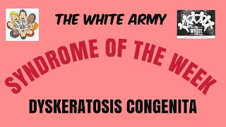 Syndromeoftheweek  DYSKERATOSIS CONGENITA  THE WHITE ARMY [upl. by Nic300]