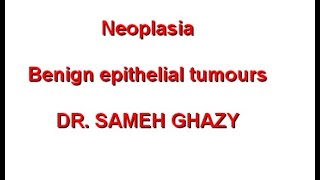 GENERAL PATHOLOGY 44  neoplasia part 3  benign epithelial tumours  DR SAMEH GHAZY [upl. by Den]