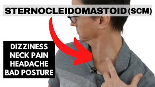 Sternocleidomastoid SCM neck pain headaches and cervicogenic dizziness [upl. by Yasui536]