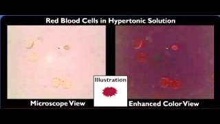 hemolysis crenation [upl. by Kayla]