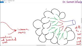 Systemic pathology 17  respiratory system 3  emphysema  DRSAMEH GHAZY [upl. by Tayib]