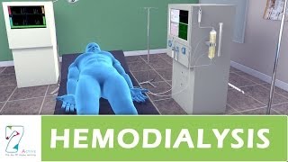 Hemodialysis [upl. by Idnil]