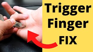 FIX Trigger Finger in 5 Minutes 3 Steps [upl. by Woolcott]