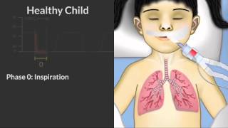 Capnography by C Smallwood  OPENPediatrics [upl. by Lytsirk]