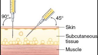 Subcutaneous Injection Demonstration [upl. by Ellecrag]