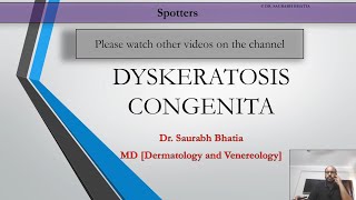 12  Dyskeratosis congenita [upl. by Zsuedat]