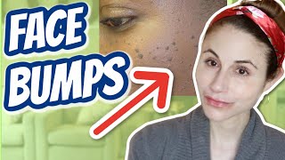 How to get rid of bumps on the face Dr Dray [upl. by Bates524]