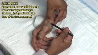 How to Give a Subcutaneous Injection [upl. by Joselow597]