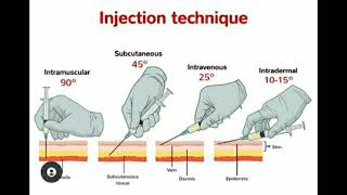 Administering a Deltoid Injection  Jones amp Bartlett Learning [upl. by Atwood582]