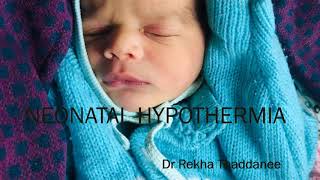 Neonatal Hypothermia  Pediatrics [upl. by Netsew]