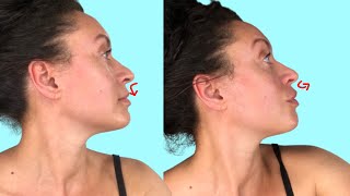 Lip plumping 5 facial exercises  Lift philtrum plump upper lip no fillers [upl. by Ahsiaa602]