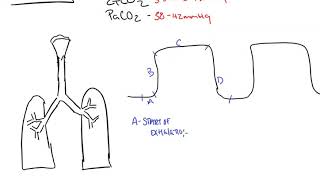 Capnography [upl. by Stedmann]