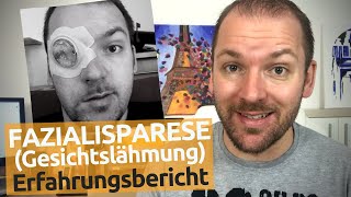 Gesichtslähmung – Diagnose Fazialisparese  Ursache Behandlung Folgen  Thomas Stradner [upl. by Eyt726]