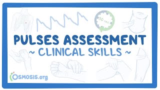 Clinical Skills Pulses assessment [upl. by Hieronymus]