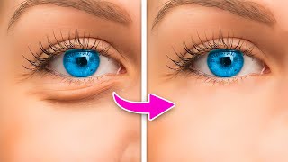 HOW TO MAKE UNDER EYE BAGS DISAPPEAR IN SECONDS [upl. by Emeric]