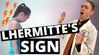 Lhermittes Sign Explained by Neurologist [upl. by Rabka]