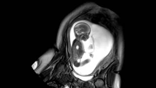 Foetal Development Unborn Baby Movement at 24 Weeks  WIRED [upl. by Tybie]