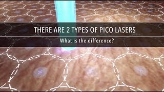 Why Are There Different Types of Pico Laser  Dr Kenneth Thean [upl. by Enovad260]