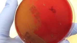 Microbiology  Hemolysis [upl. by Dun]