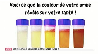 COMMENT TRAITER LES INFECTIONS URINAIRES [upl. by Dunson]