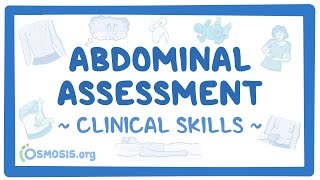 Abdominal Assessment Clinical Skills [upl. by Icyaj790]