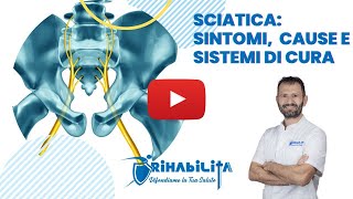 SCIATICA SINTOMI  CAUSE  SISTEMI DI CURA EFFICACI [upl. by Enyamart]